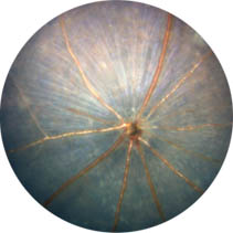 Eyemera FUNDUS-01