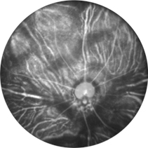 Eyemera FUNDUS-03